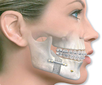 Oral and Maxillofacial Surgery 